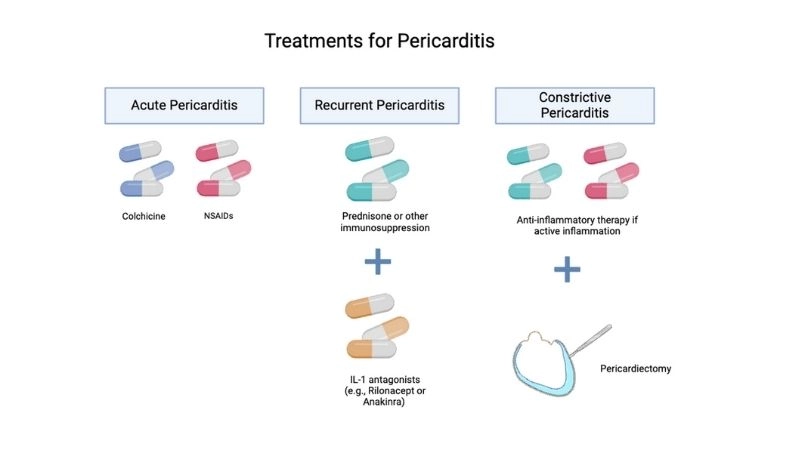 Constrictive pericarditis echocardiography imaging for diagnosis