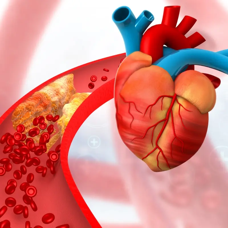 CAD treatment options for heart health management