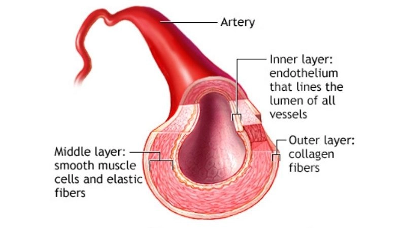 Healthy living with prinzmetals angina diet