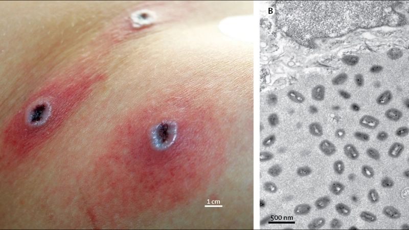 Cowpox in animals spreads quickly