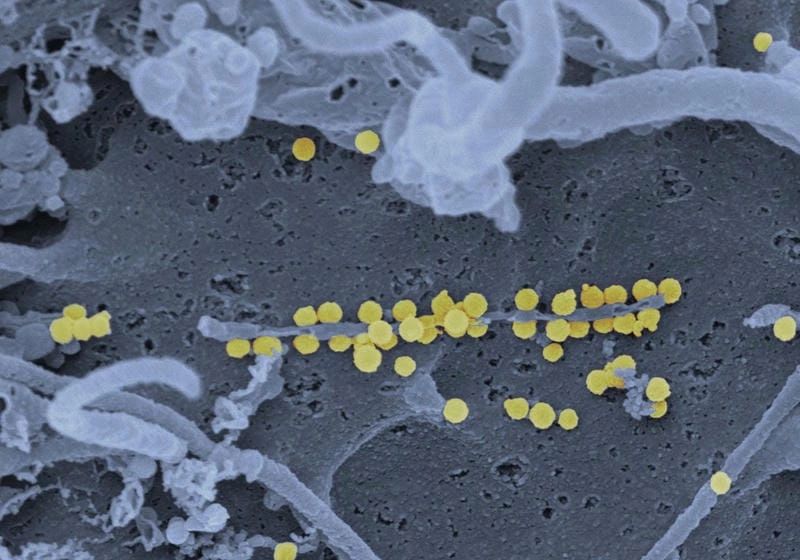 Following official CCHF treatment guidelines