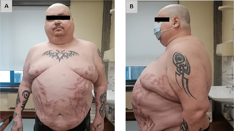 Lab results showing high cortisol levels in blood test