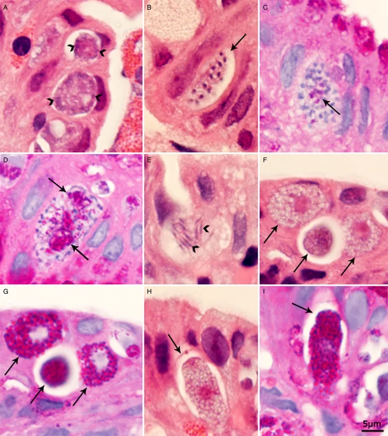 Answering if is cyclosporiasis contagious person-to-person