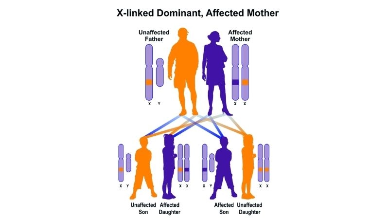 Danon disease causes genetic mutations affecting organs