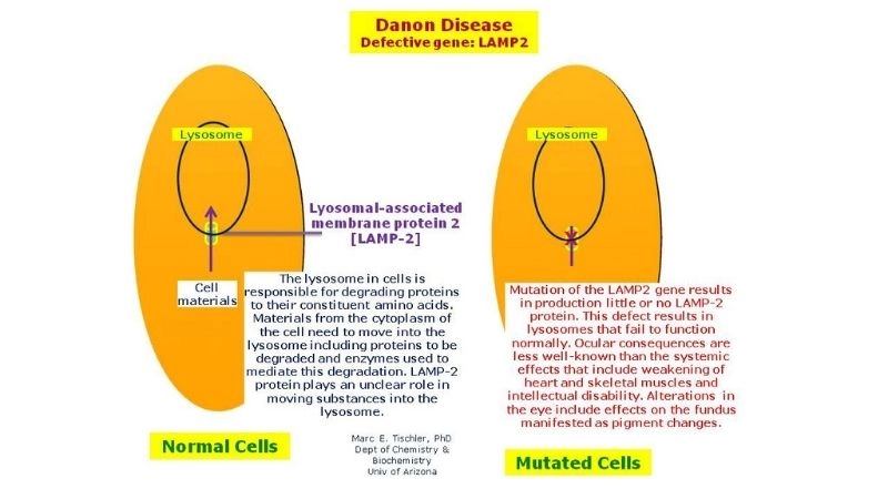 Danon disease genetic testing identifying inherited risk factors