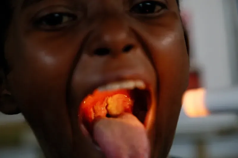 The Corynebacterium diphtheriae bacteria