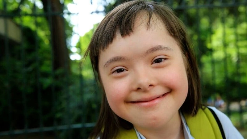 Patent ductus arteriosus in Down syndrome babies