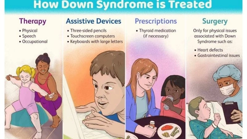 Down syndrome echocardiogram for diagnosis