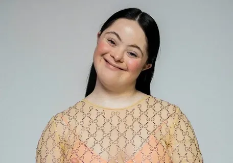 Down syndrome life expectancy and health outlook