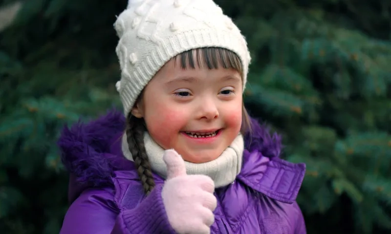 Types of down syndrome and key differences explained