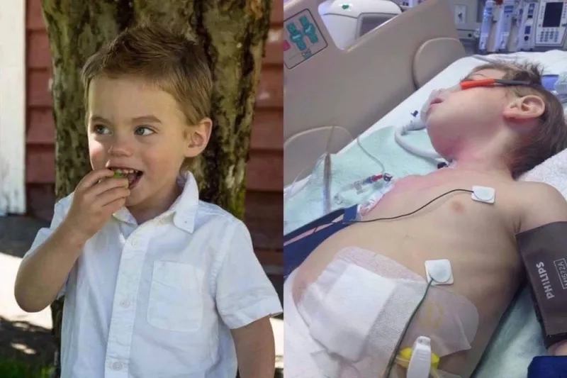 Standard e coli treatment protocol