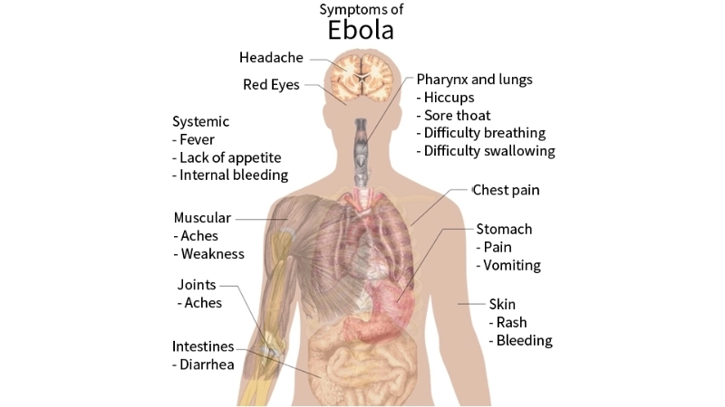 Ebola prevention tips for everyday safety