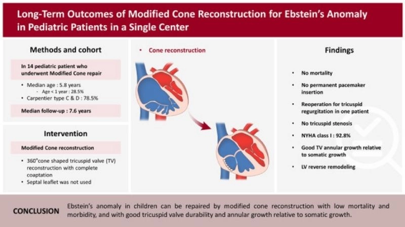 Ebstein's anomaly and pregnancy risks and considerations