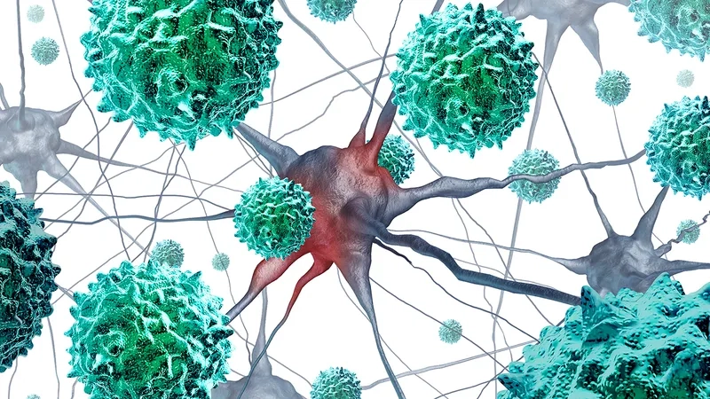 Recognizing common echovirus symptoms in adults