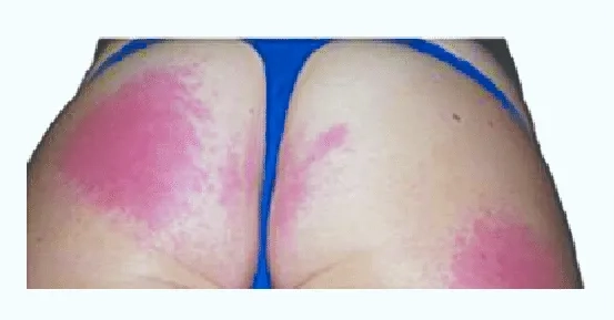 A doctor examining a baby with echovirus in infants