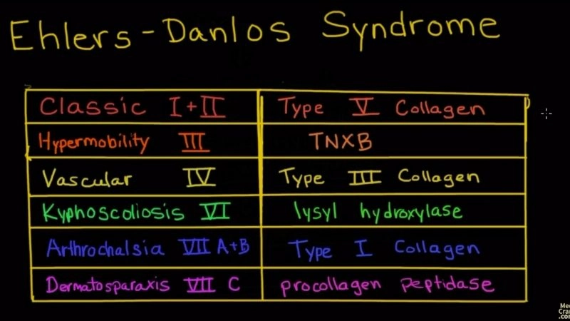 Options for vascular Ehlers-Danlos syndrome treatment