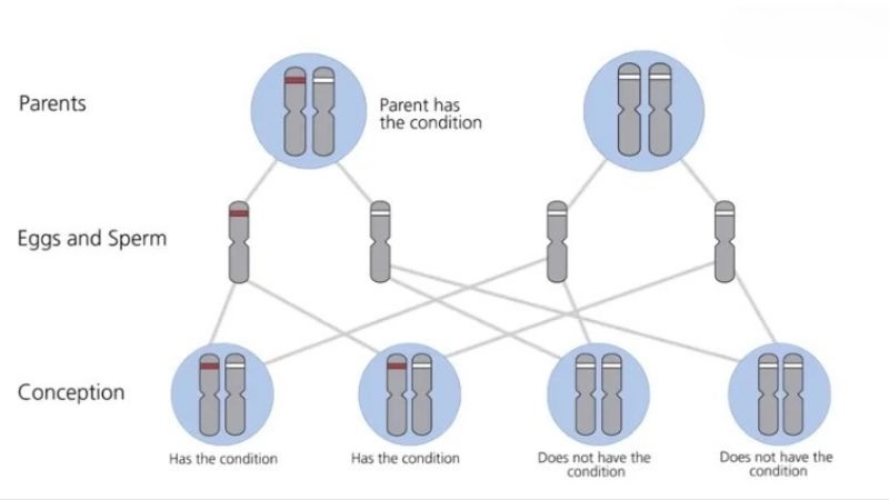 Prognosis and vascular EDS life expectancy