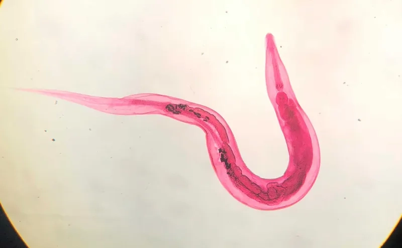 Understanding how do you get pinworms