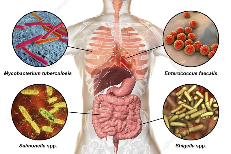 Recognizing common symptoms of Enterococcus faecalis