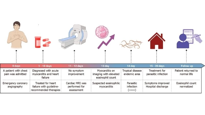 Eosinophilic myocarditis prognosis outcome depends on early care