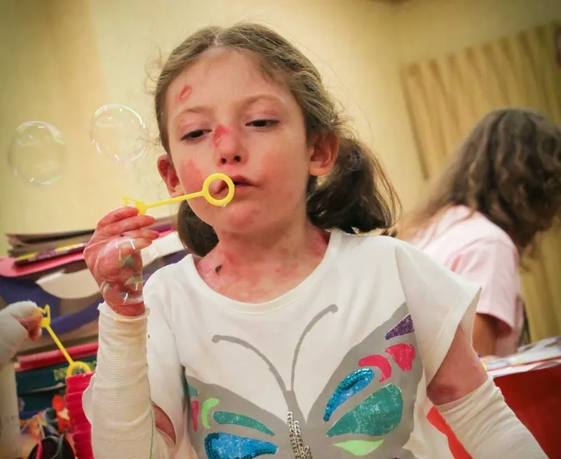 Discussing EBA autoimmune disease treatment options