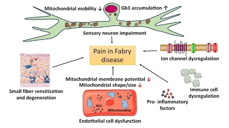 Fabry disease eye manifestations detail