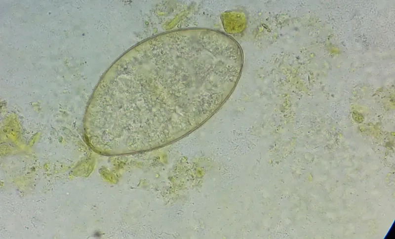 Understanding the Impact of Liver Fluke Disease