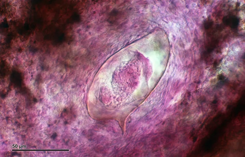 Exploring Effective Fascioliasis Treatment Options