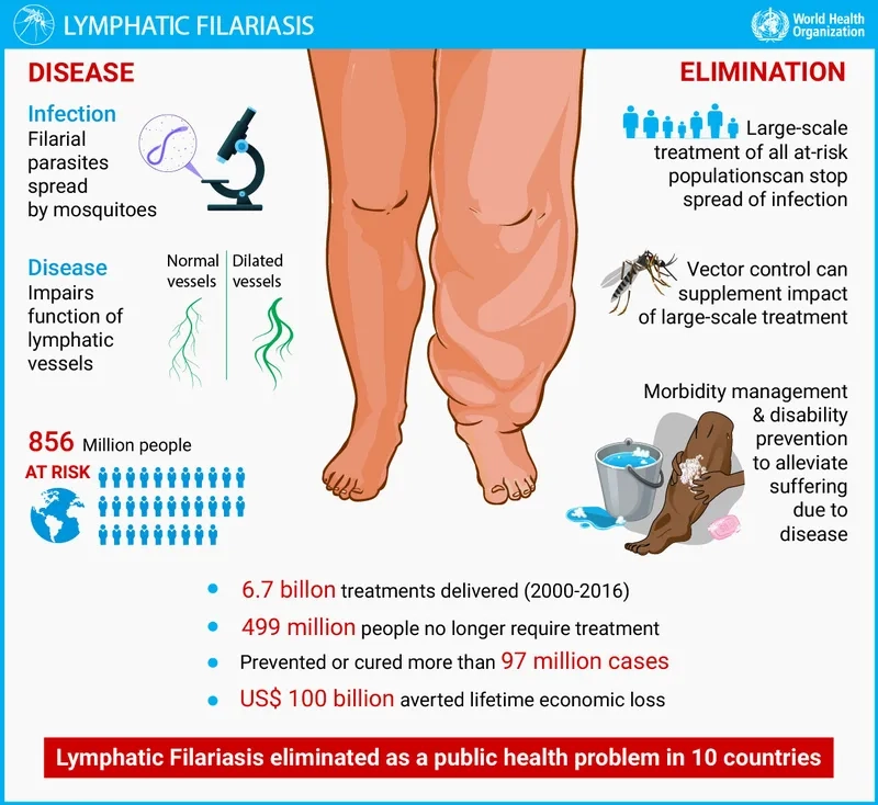 Chart illustrating common filariasis symptoms