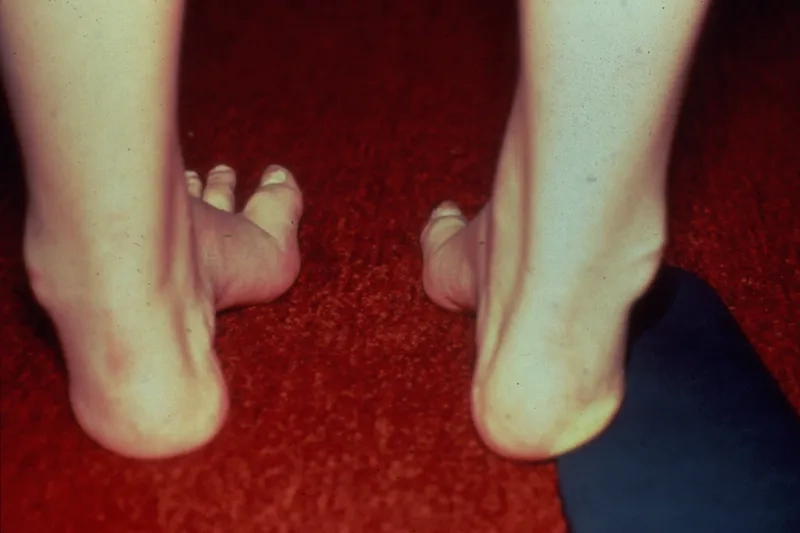 The role of frataxin in cellular health