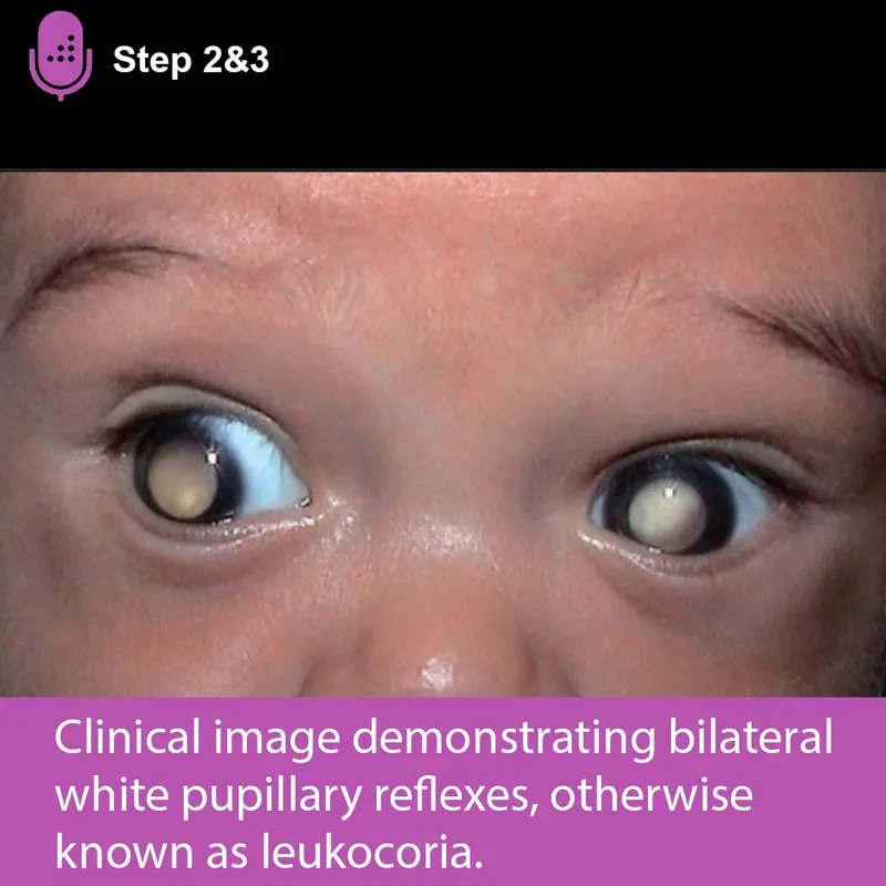 A flowchart of the galactosemia diagnosis process