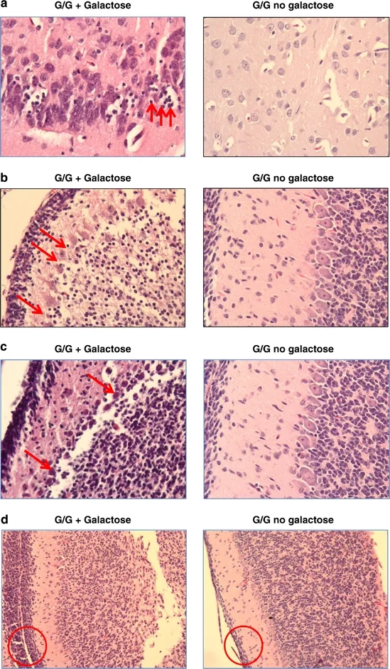 A list of foods to avoid with these dietary restrictions