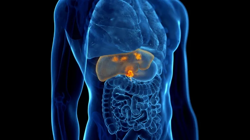 Patient learning about gallbladder cancer symptoms