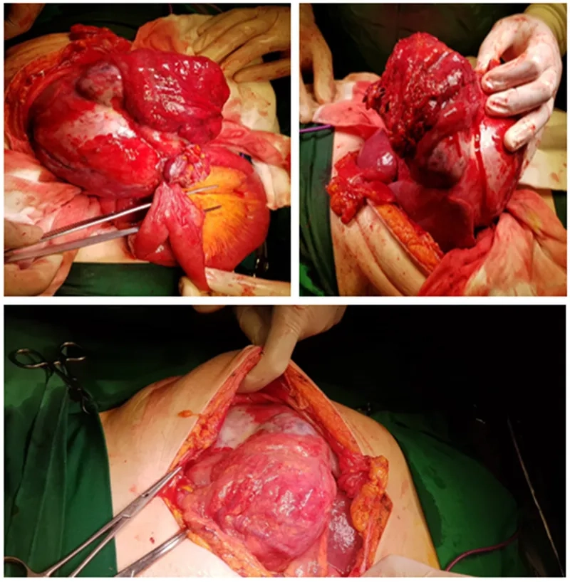 Medical professional reviewing signs of gallbladder cancer