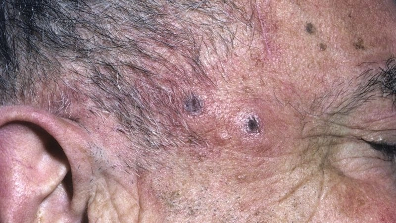 Imaging for GCA in modern clinical practice