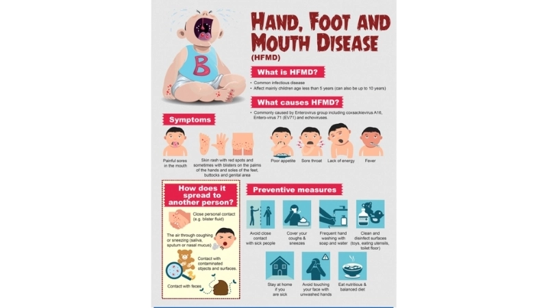 Hand Foot and Mouth Disease in adults explained