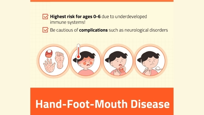 HFMD encephalitis shows severe neurological risk