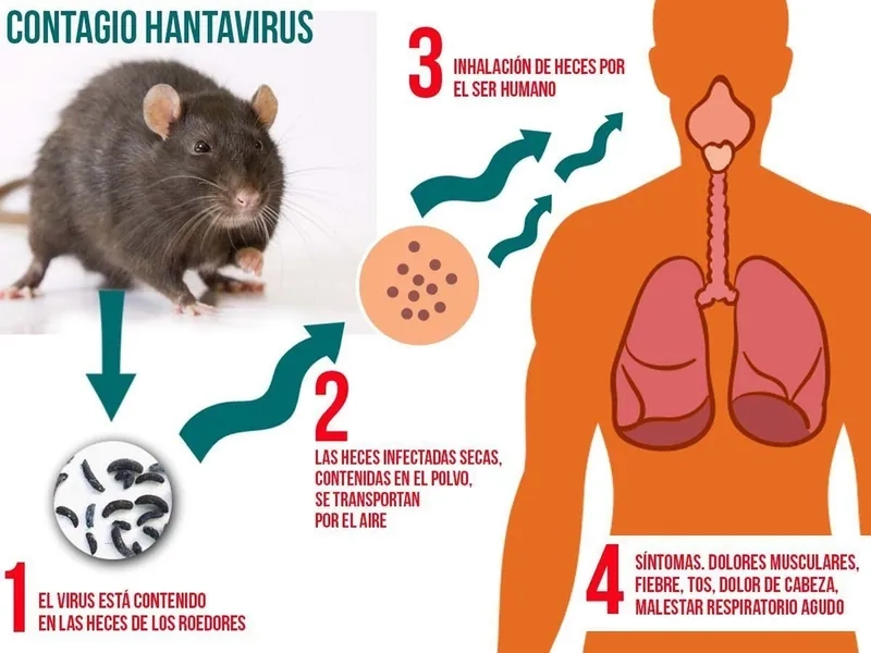 Fever and muscle aches are key hantavirus symptoms