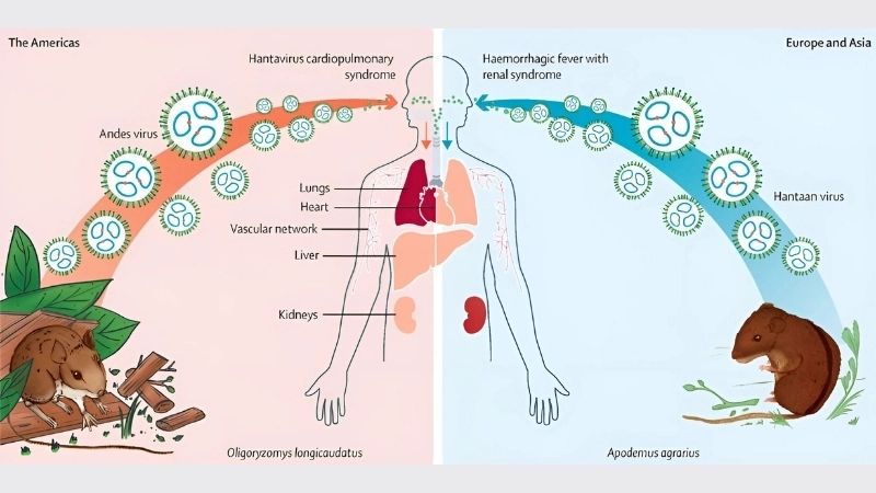 Simple tips for Hantavirus prevention daily