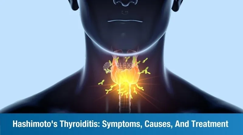 Hashimoto's symptoms and clinical health signs
