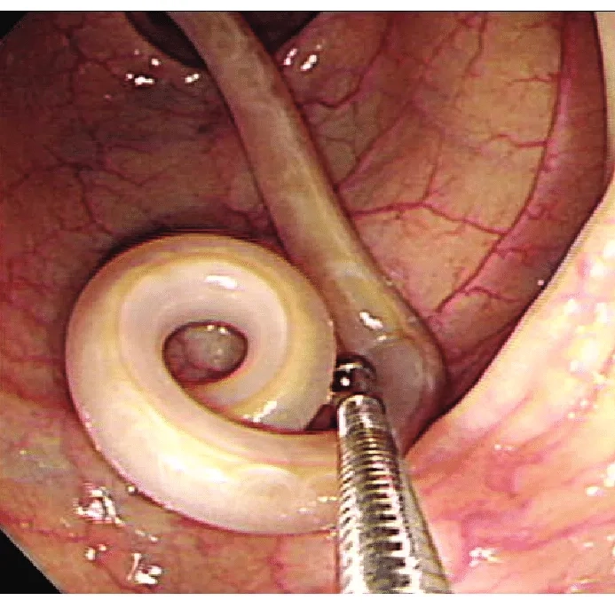 The life cycle of soil-transmitted helminths