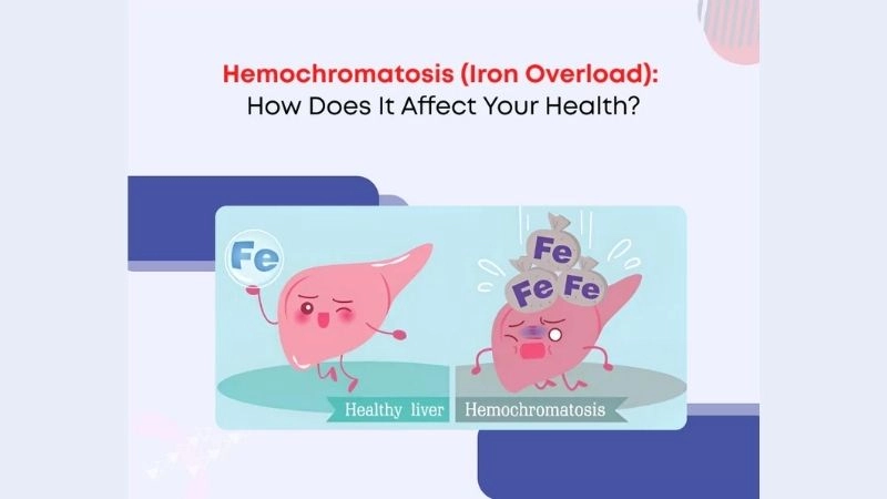 Early warning signs of hemochromatosis symptoms