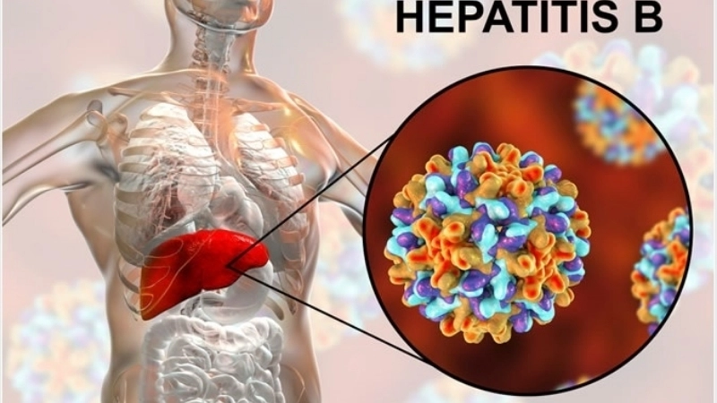 Hepatitis B and liver cancer risks