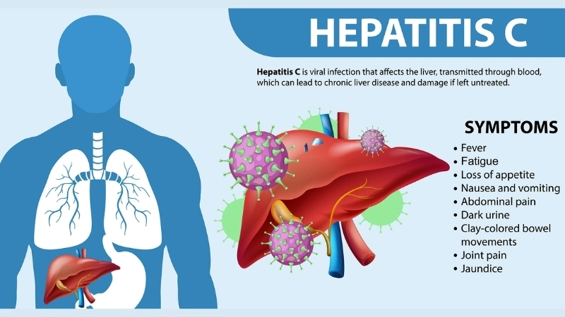 A display of the latest hepatitis C treatment drugs