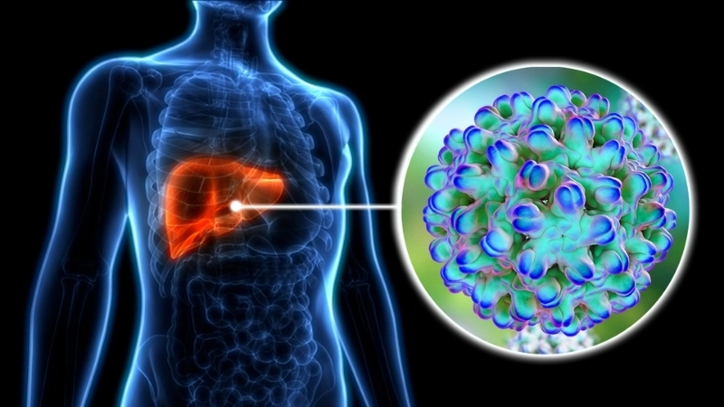 Hepatitis D symptoms and Hepatitis D guide