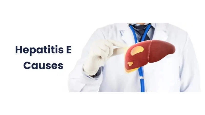 Acute Hepatitis E shows sudden health risk