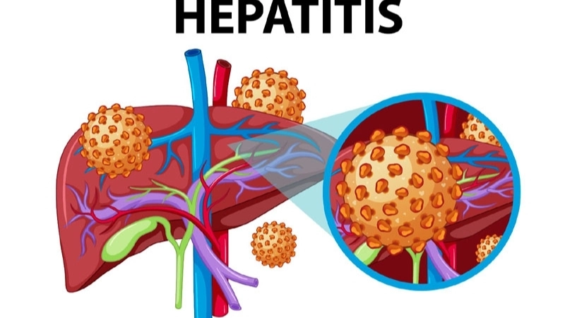 Effective Hepatitis E treatment for patients