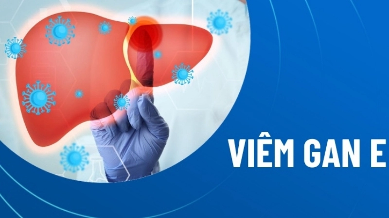 Hepatitis E vaccine offers vital protection