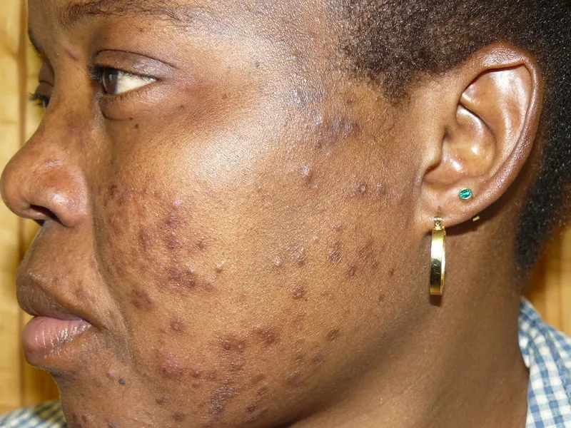 The current scientific status on the question 