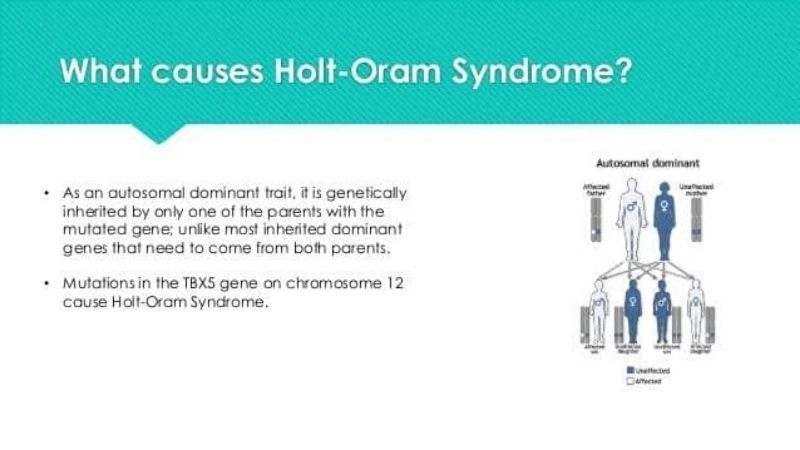 Holt-Oram syndrome symptoms identification